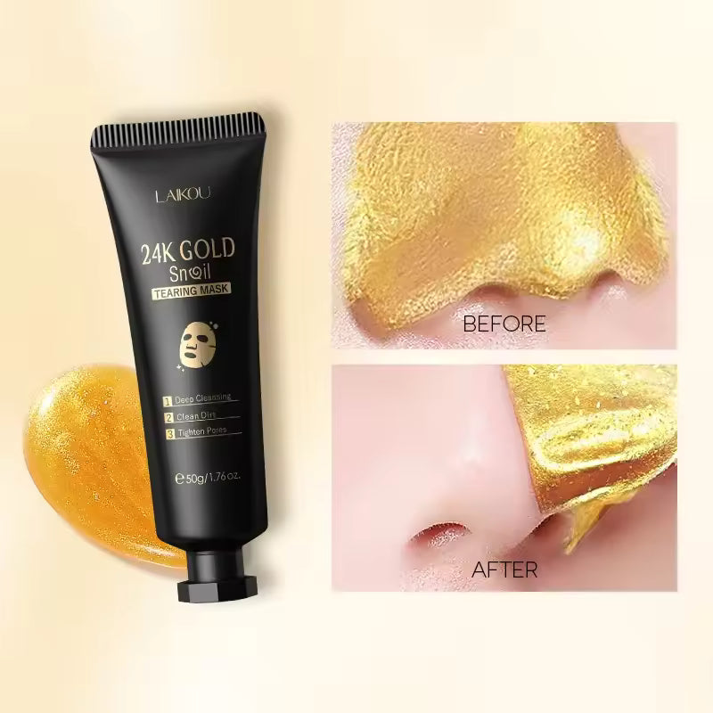 LAIKOU 24K Gold Facial Peeling Mask – Deep Cleansing & Blackhead Removal